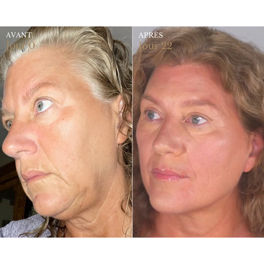 Velmya™ | Le Reset Visage en 2 Minutes