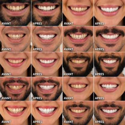 Siwak Pure™ I Le bâton naturel qui blanchit tes dents sans dentifrice